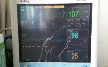 在监护室的心得体会7篇